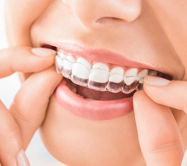 Hialeah Does Invisalign Really Work